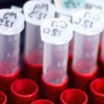 STD Testing: Which Tests Are Right for You? STD Testing: Which Tests Are Right for You?