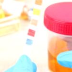 Why Is Your Urine Color Different?