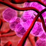 Anemia Treatment Options: A Comprehensive Guide Anemia Treatment Options: A Comprehensive Guide