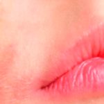 Facial Psoriasis: Essential Info & Treatment Options