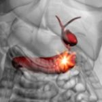Keeping Your Gallbladder: Importance & How To Do It