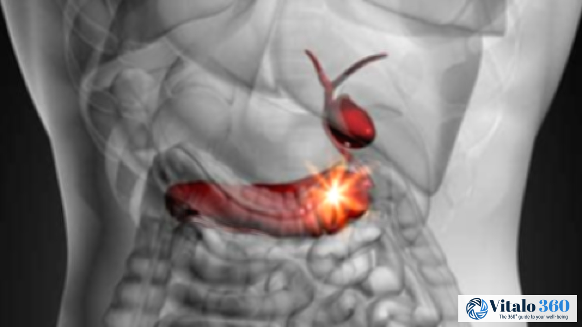 Keeping Your Gallbladder: Importance & How To Do It