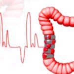 Nutrition’s Role in Colon Cancer Treatment: What You Need
