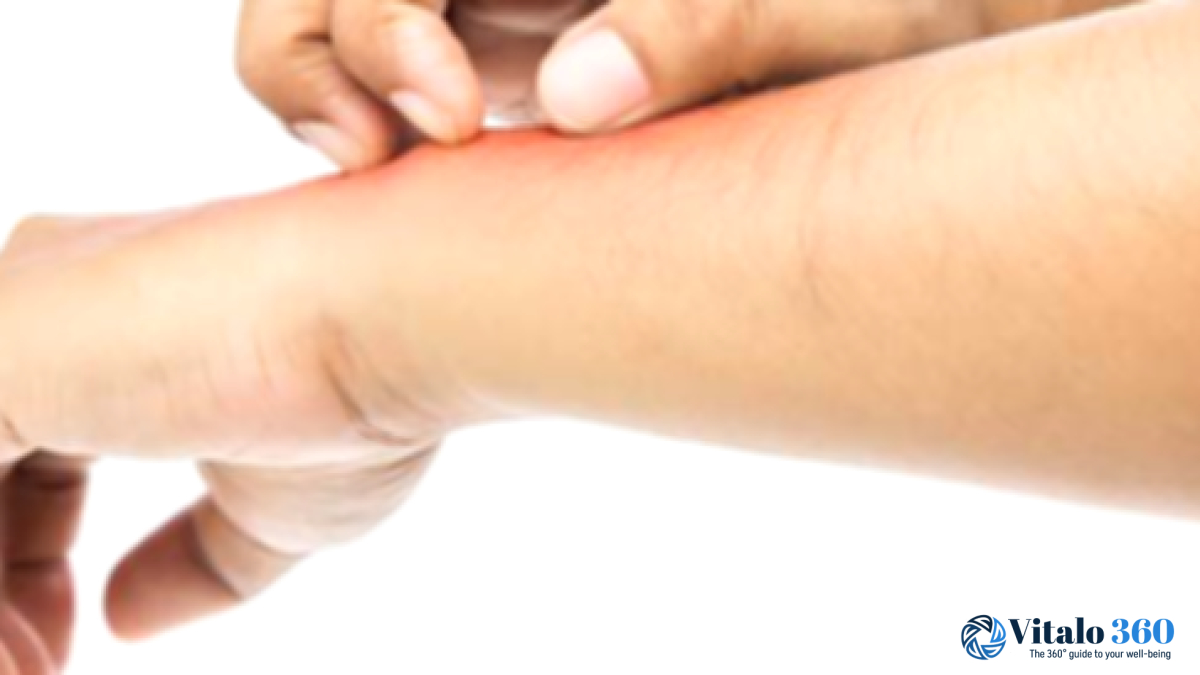 Wrist Rash? Possible Causes and How to Find Relief