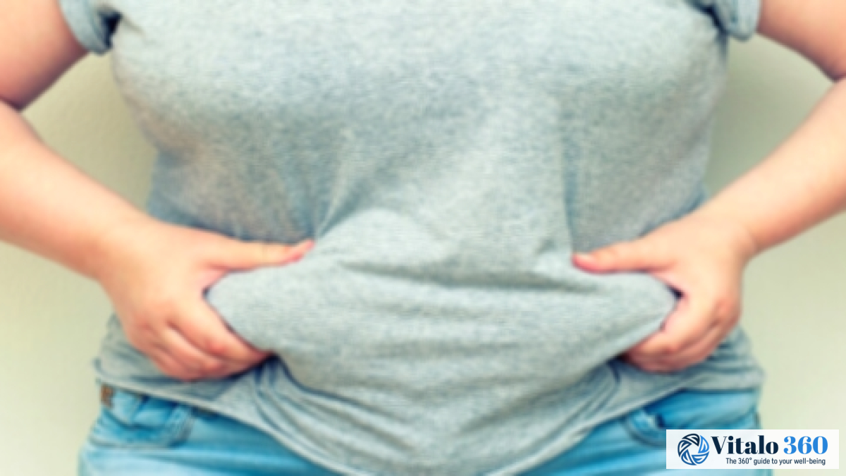 Belly Fat Buildup: Causes, Risks, and Proven Solutions