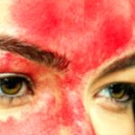 Bloody Sweat: Understanding This Rare Medical Condition