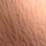 Breast Stretch Marks: Causes, Prevention & Care Breast Stretch Marks: Causes, Prevention & Care