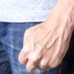 Bulging Veins: Causes, Symptoms and Treatment Options