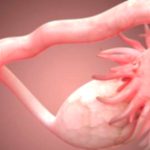 Early Ovarian Failure: Causes, Symptoms & Treatment early ovarian failure causes symptoms treatment
