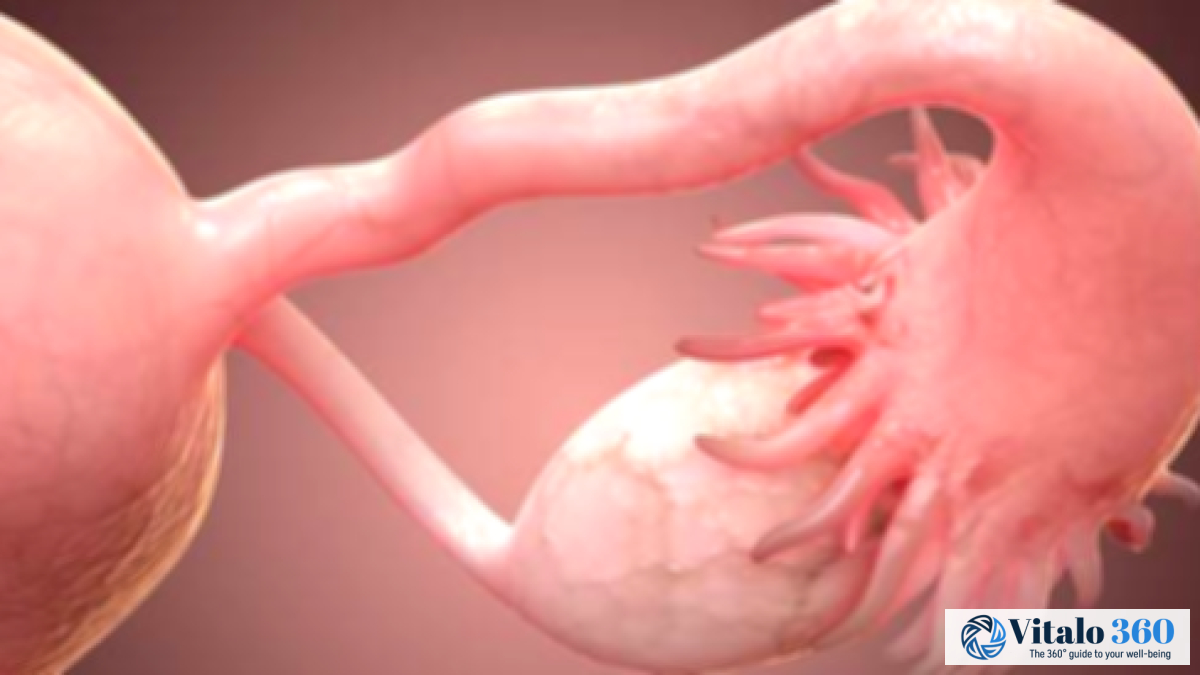 Early Ovarian Failure: Causes, Symptoms & Treatment