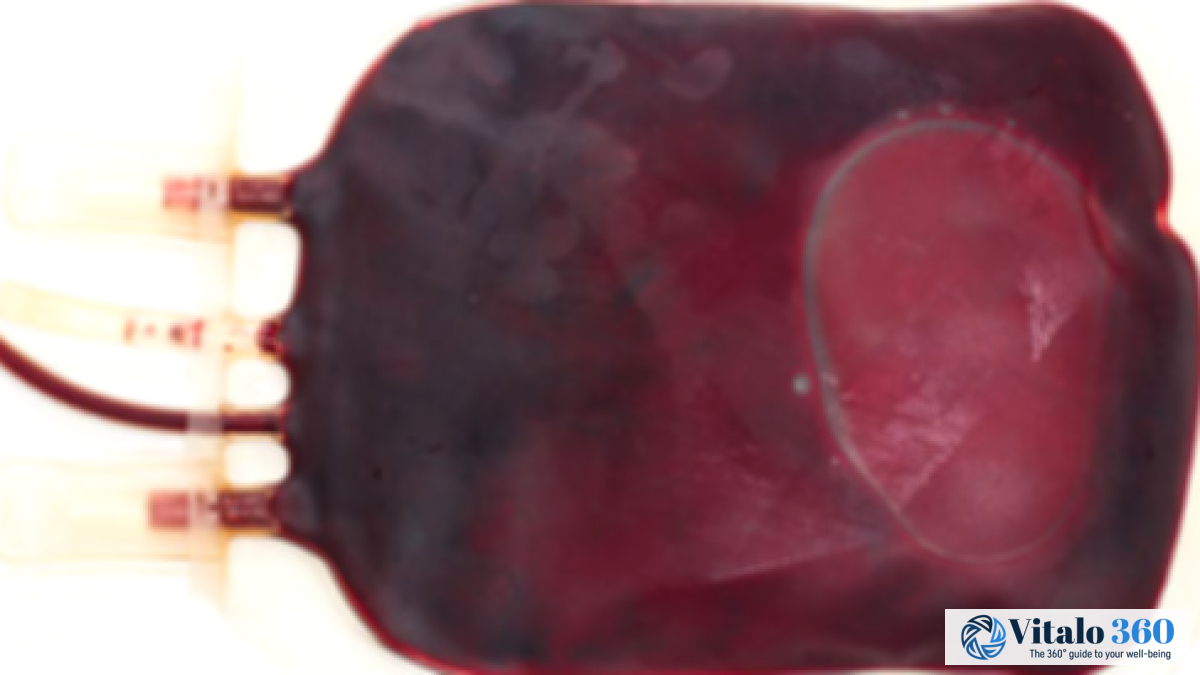 Fluid Overload: What You Need to Know About Hypervolemia