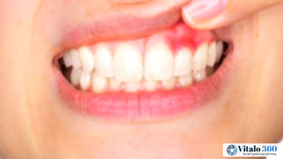 Gum Disease Prevention: Top Tips for Healthy Gums