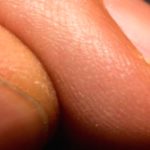 Hangnail Help: Causes & Simple Home Treatments Hangnail Help: Causes & Simple Home Treatments
