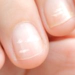 Healthy Nails, Healthy You: What Your Nails Say Healthy Nails, Healthy You: What Your Nails Say