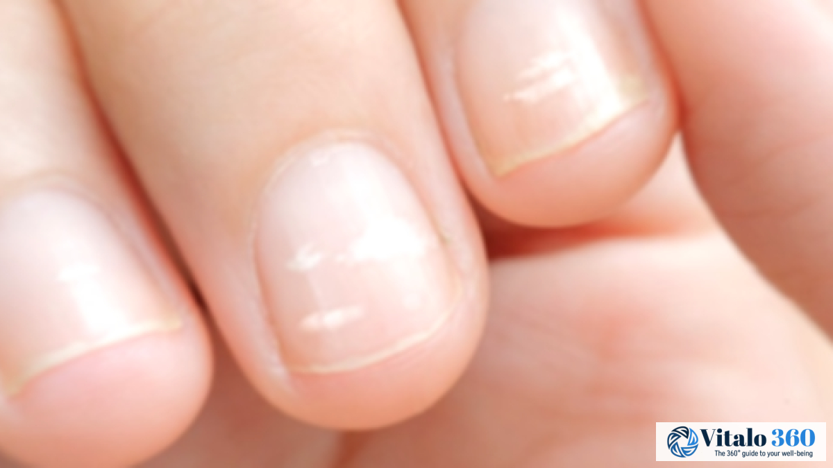 Healthy Nails, Healthy You: What Your Nails Say Healthy Nails, Healthy You: What Your Nails Say
