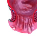 Hemorrhoids Causes: Understanding the Reasons