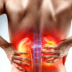 Kidney Prolapse: Causes, Symptoms, and Treatment Options