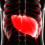 Liver Cysts: Are You at Risk Without Knowing? Liver Cysts: Are You at Risk Without Knowing?