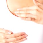 Nipple Discharge: Causes & When to See a Doctor