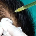 Platelet-Rich Plasma (PRP) Injections: Key Details Platelet-Rich Plasma (PRP) Injections: Key Details