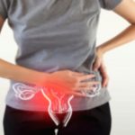 Polycystic Ovary Syndrome (PCOS) Treatment Options Polycystic Ovary Syndrome (PCOS) Treatment Options