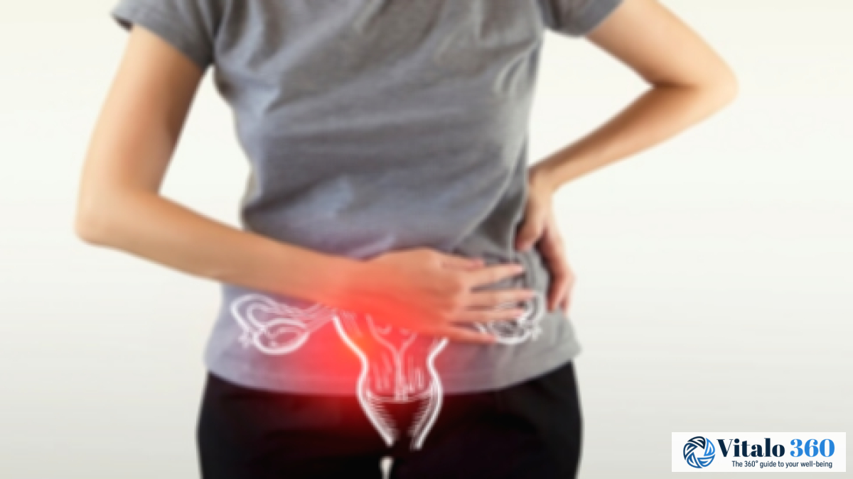 Polycystic Ovary Syndrome (PCOS) Treatment Options