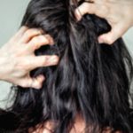 Scalp Problems and Effective Treatment Options