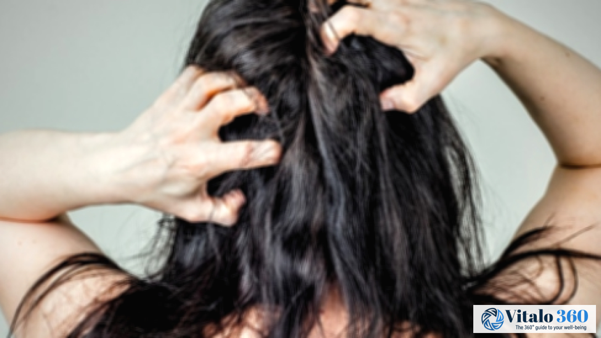 Scalp Problems and Effective Treatment Options