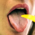 White Tongue Causes: What You Need to Know White Tongue Causes: What You Need to Know