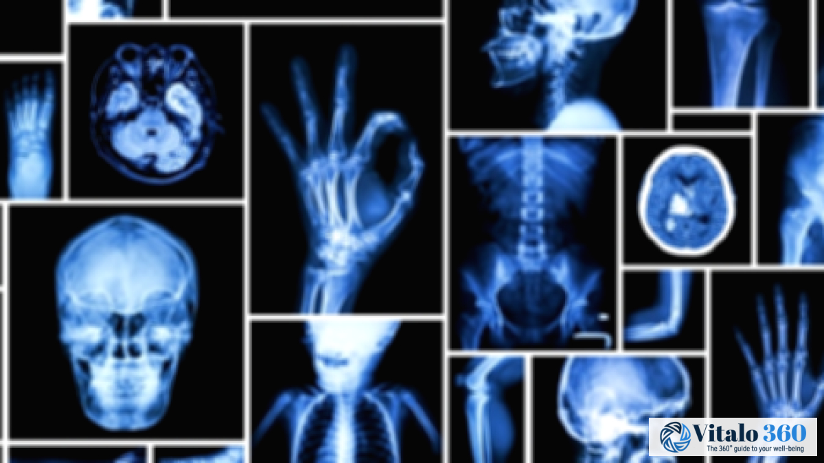 X-Rays: Balancing the Benefits and Potential Risks
