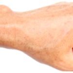 Body Cysts: Types, Causes, and What You Need to Know Body Cysts: Types, Causes, and What You Need to Know