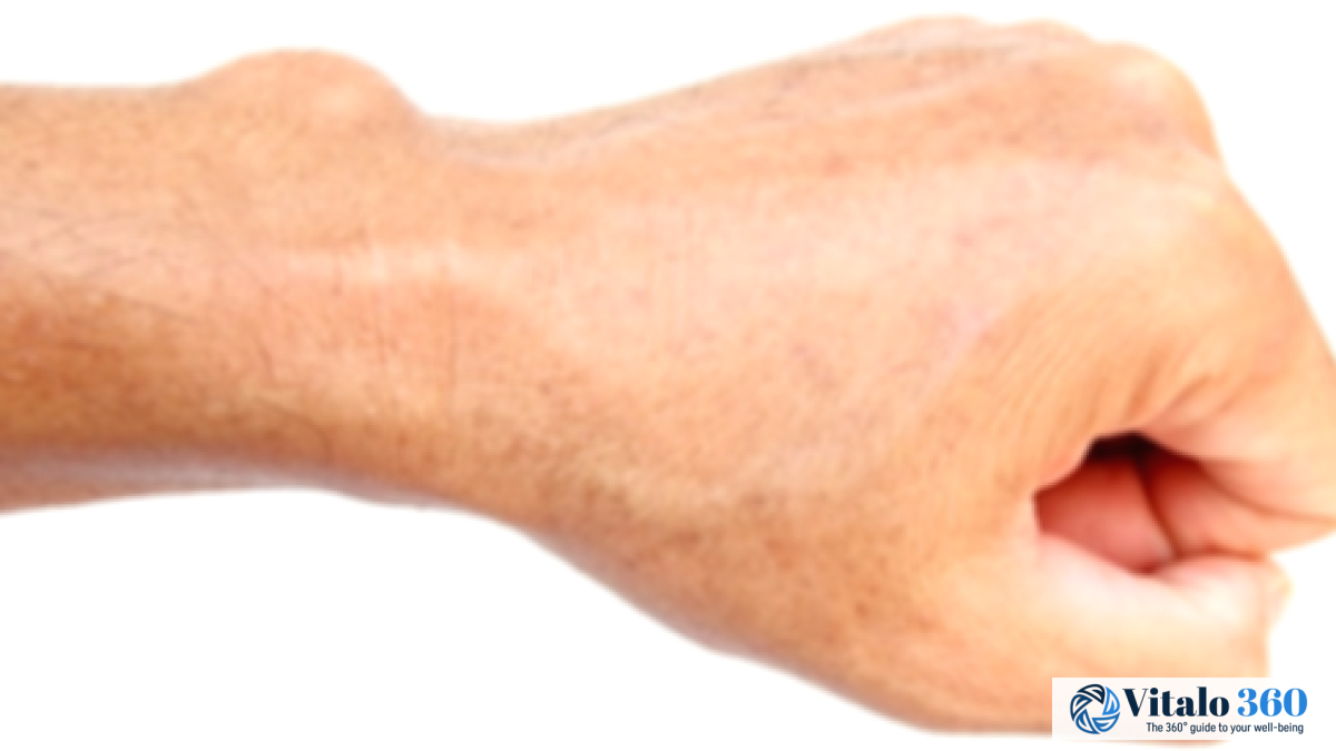 Body Cysts: Types, Causes, and What You Need to Know Body Cysts: Types, Causes, and What You Need to Know