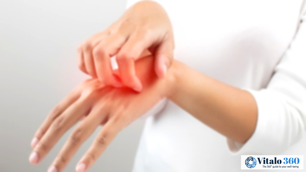 Soothing Itch Relief: Proven Methods & Recipes